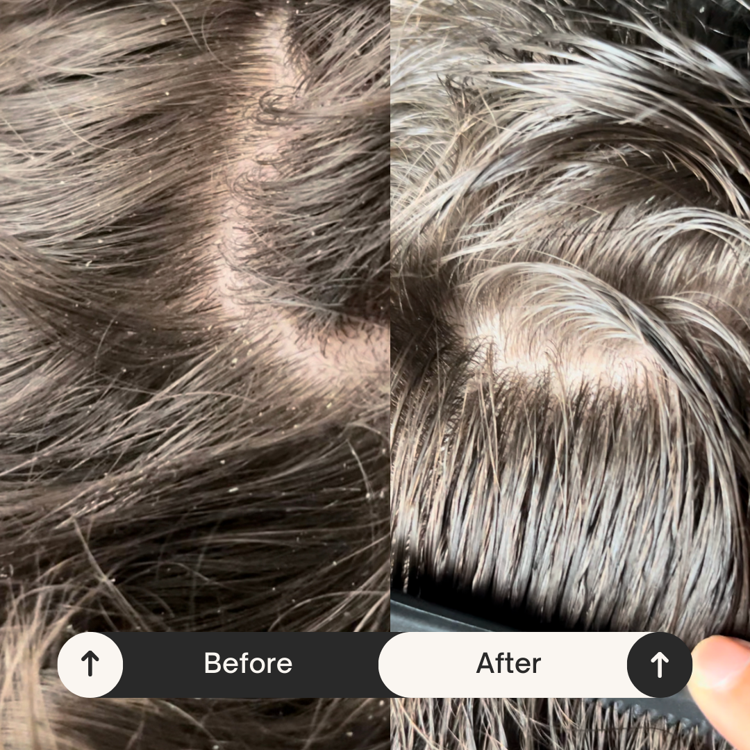 SARI CURLS | Scalp Brush Bürsten & Kämme SARI CURLS