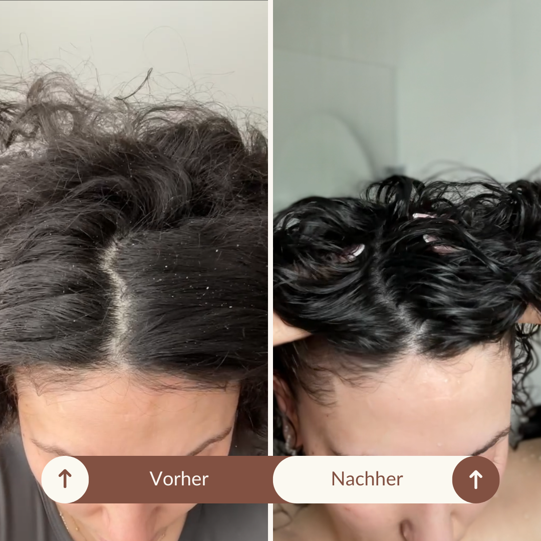 SARI CURLS | Scalp Brush Bürsten & Kämme SARI CURLS | Dein Lockenshop